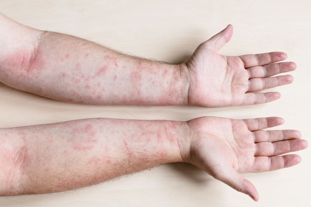 How Skin Diseases Treatment Restores Confidence