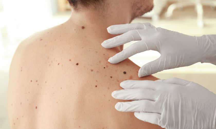 How Skin Lesion Removal Enhances Skin Texture