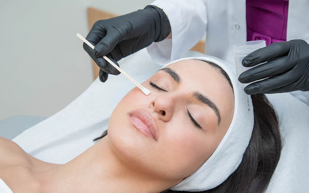 How does a chemical peel help reduce skin discoloration?