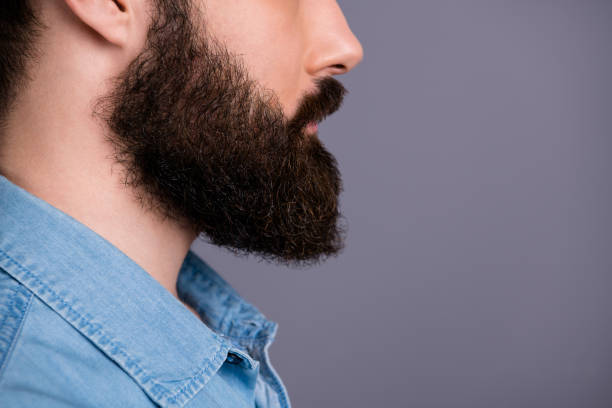 Is Beard Hair Transplant a Good Fix for Thin Chin Hair