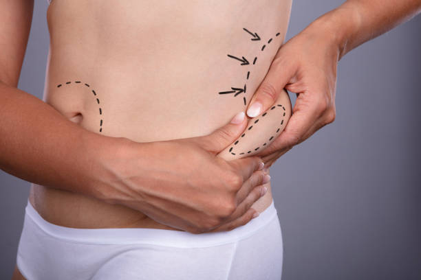 Is Body Jet Liposuction Safe For Small Areas With Less Downtime