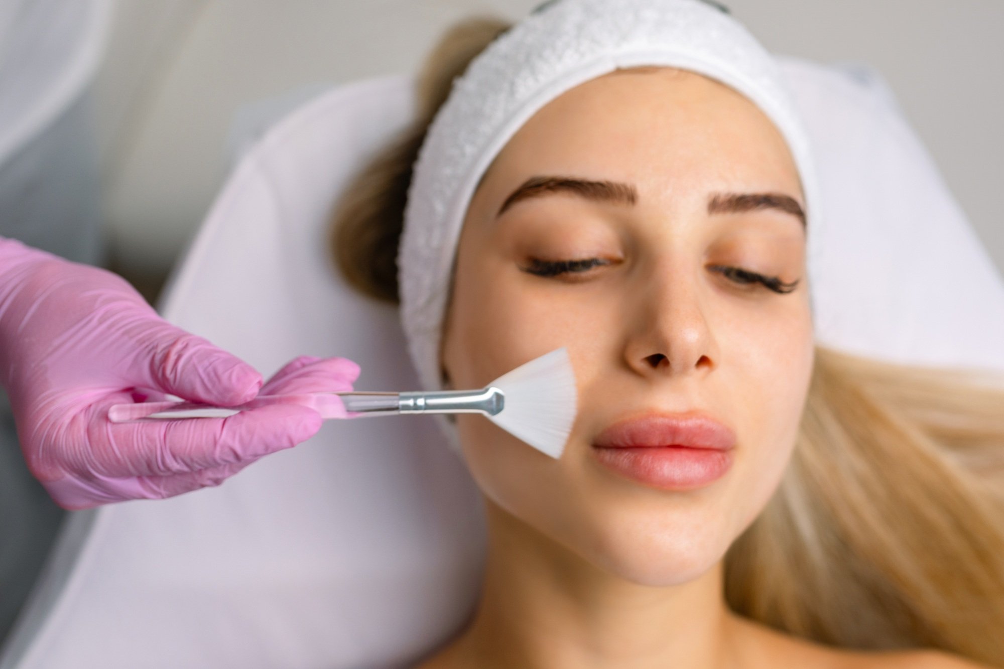 Is Chemical Peel Suitable for Reducing Skin Roughness?
