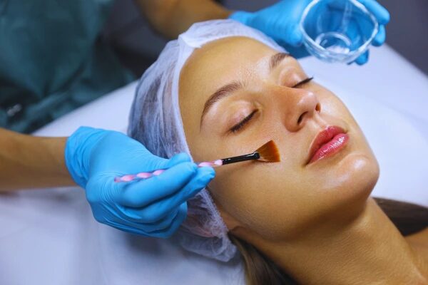 Is Chemical Peel Useful for Reducing Dark Circles?