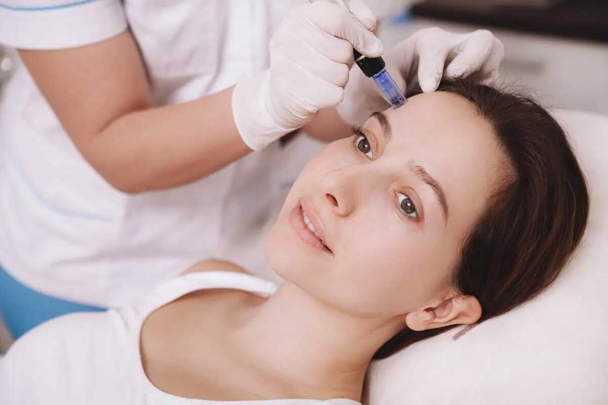 Is Microneedling for Acne Scars Safe for Skin