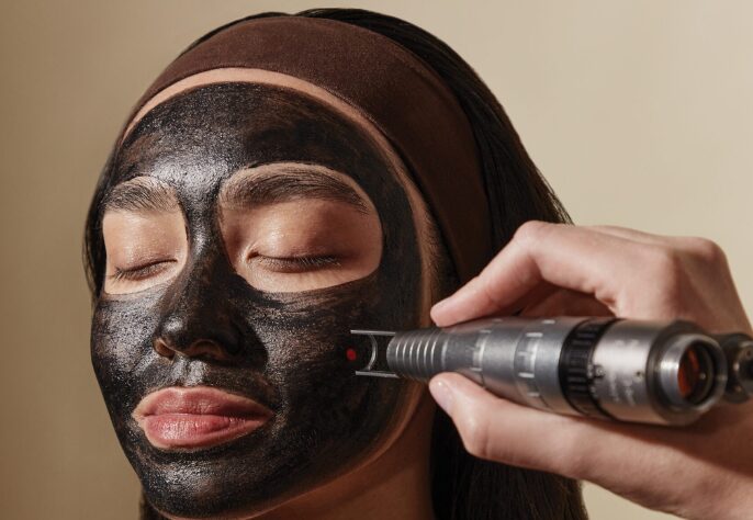 Laser Carbon Peel for Facial Cleansing: How It Works