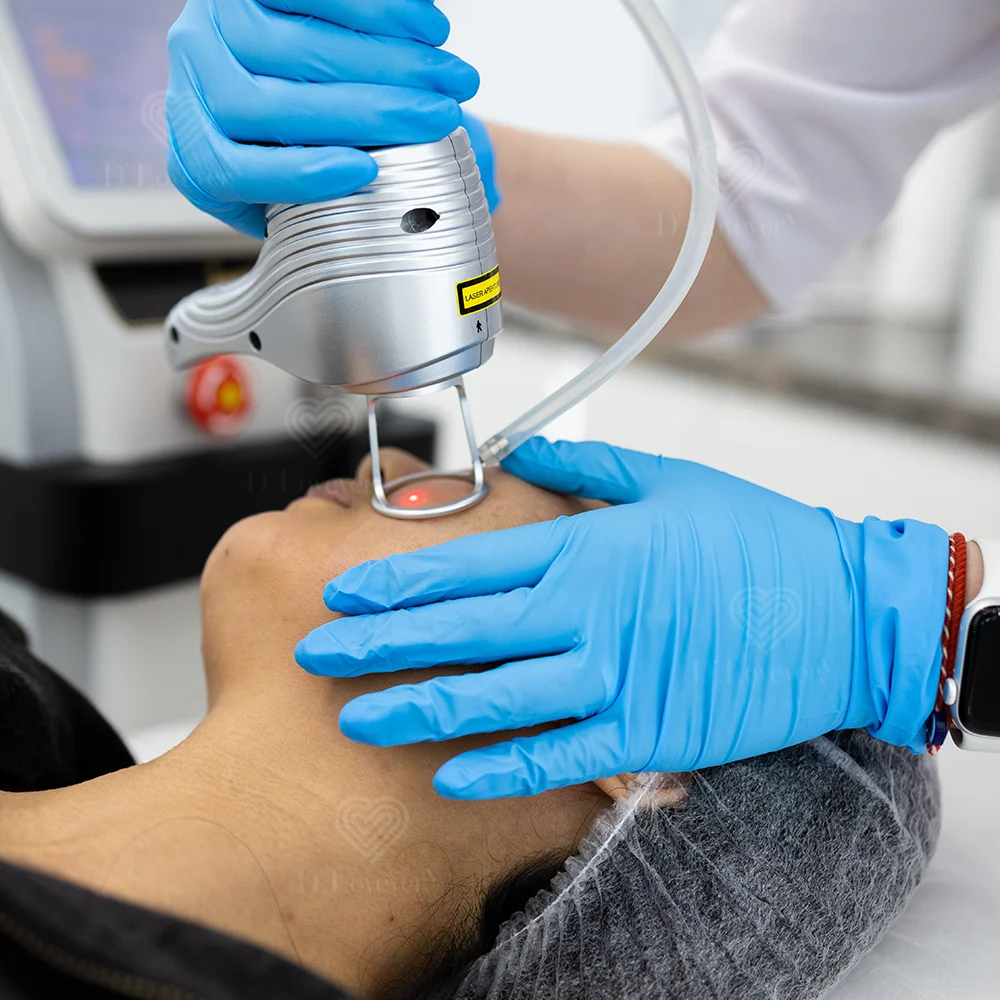 Say Goodbye to Acne Scars with Advanced Laser Care