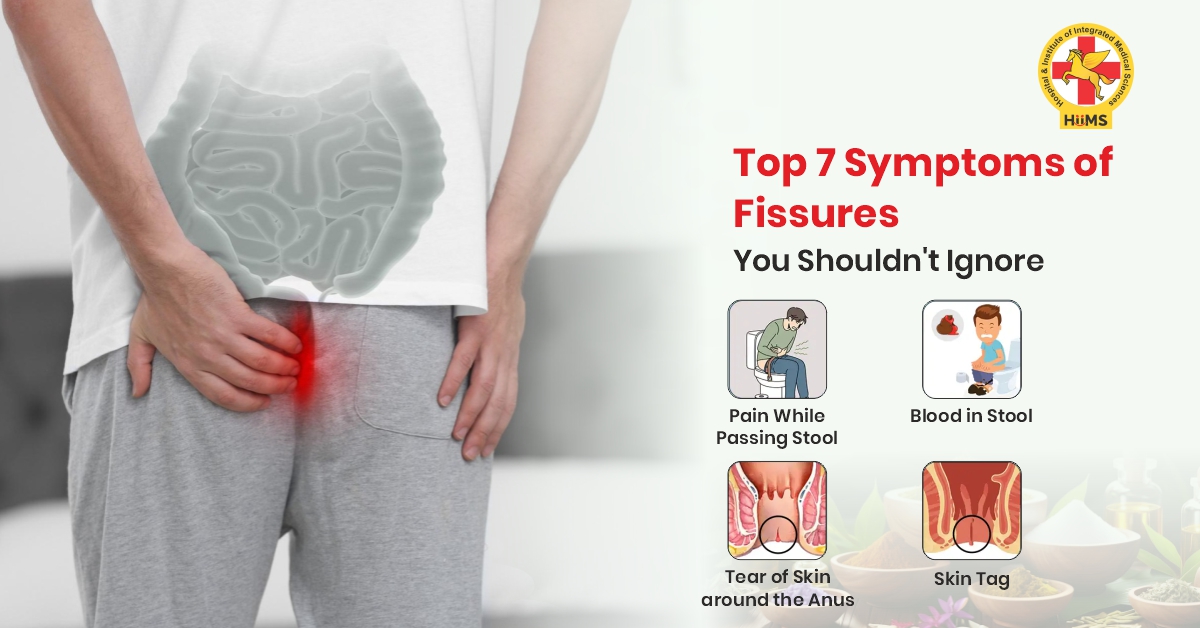 Fissure Symptoms: Common Signs, Causes, and Natural Ways to Support Healing