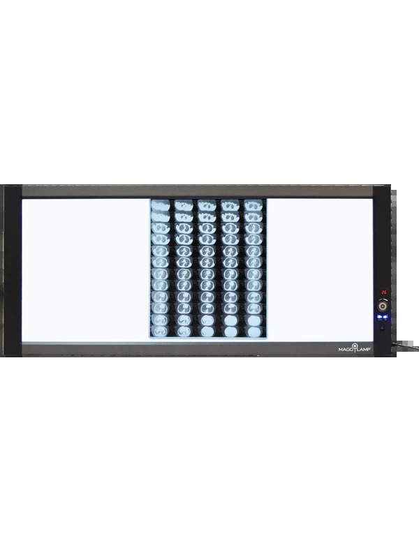 Questions to Ask Before Buying LED X-Ray Viewers in Australia