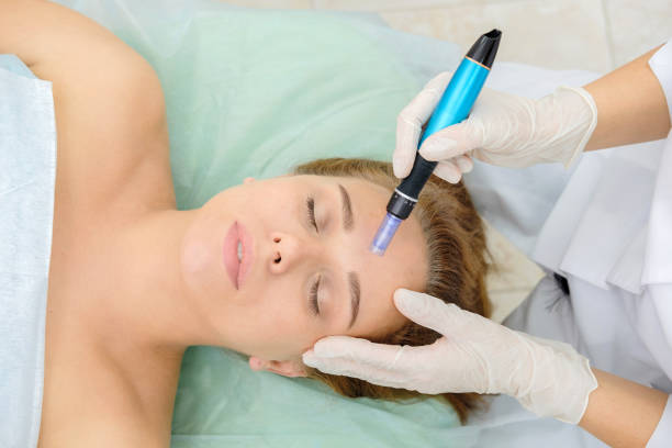 What Are the Latest Trends in microneedling Treatments