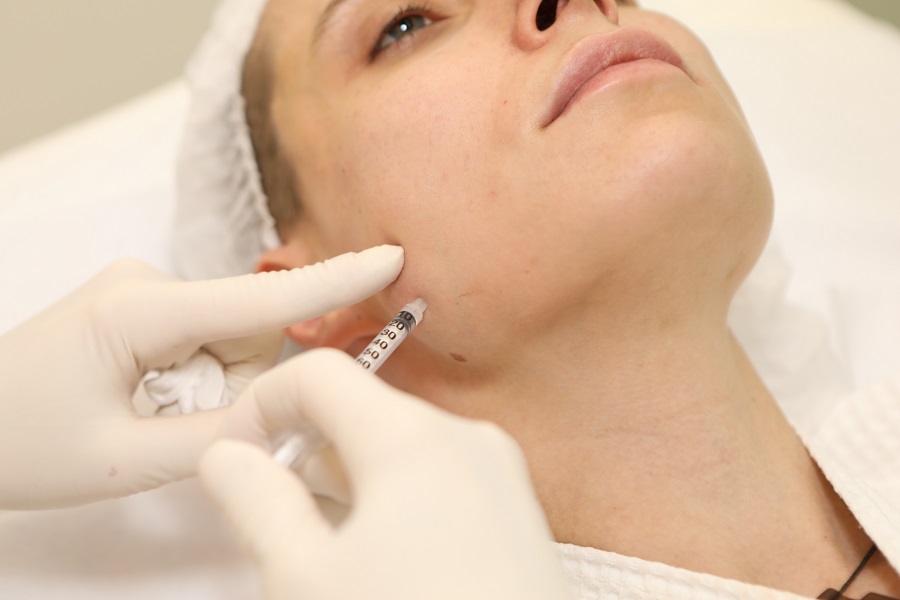 What Can Jawline Fillers Do for Facial Definition?