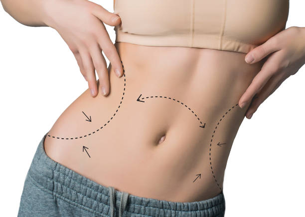 What Makes Liposuction Results Look So Natural When Done Well