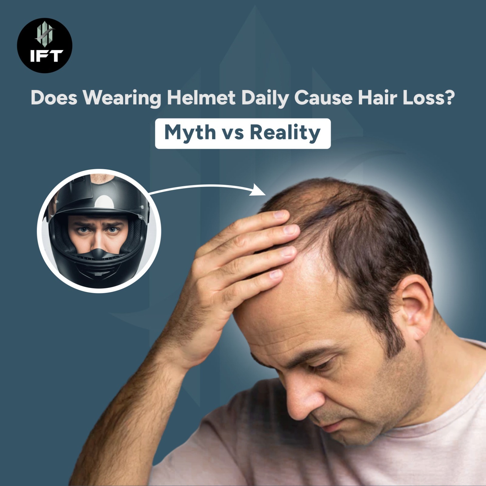 Does Wearing Helmet Daily Cause Hair Loss? Myth vs Reality.