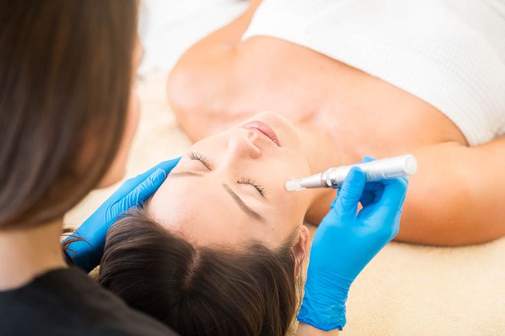 Why Is HydraFacial Popular Before Weddings and Events?