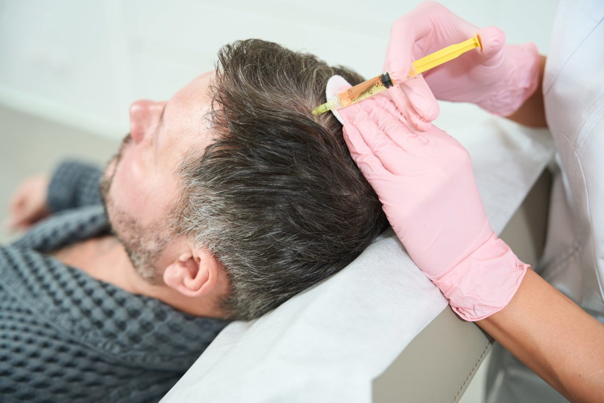 Why PRP Treatment Is Trending in Hair Regrowth?