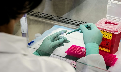 Beyond the Sequence: What a Modern Glycoproteomics Platform Reveals About Protein Function