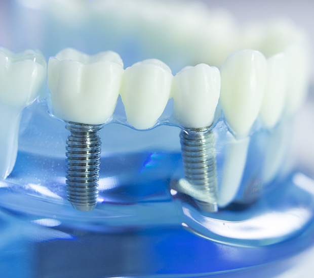 What to Expect From Dentures And Family Dentistry Clinics