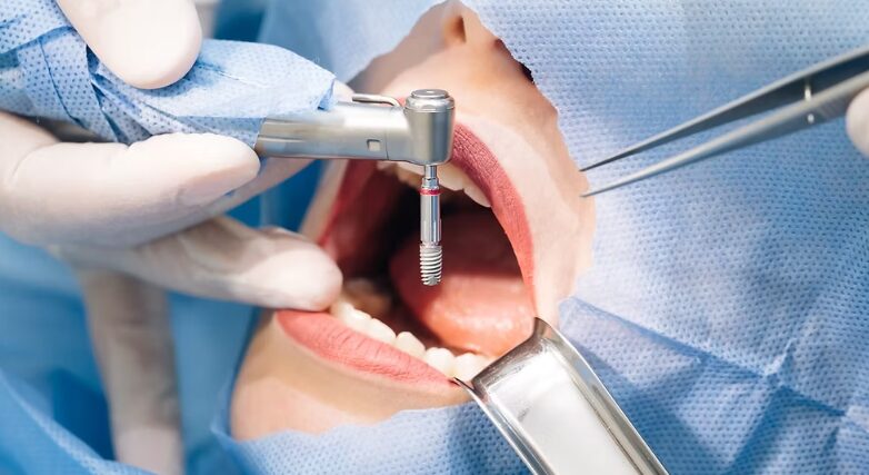 Is cosmetic dentistry Scarborough worth your smile today?