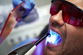 Laser Dentistry Explained: A Modern, Comfortable Approach to Dental Care