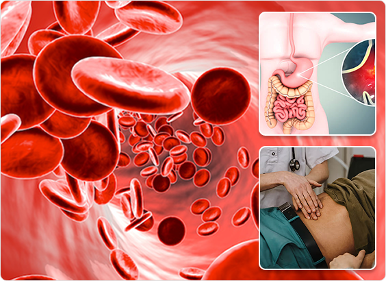 Why Early Consultation with an Ulcer Specialist Matters