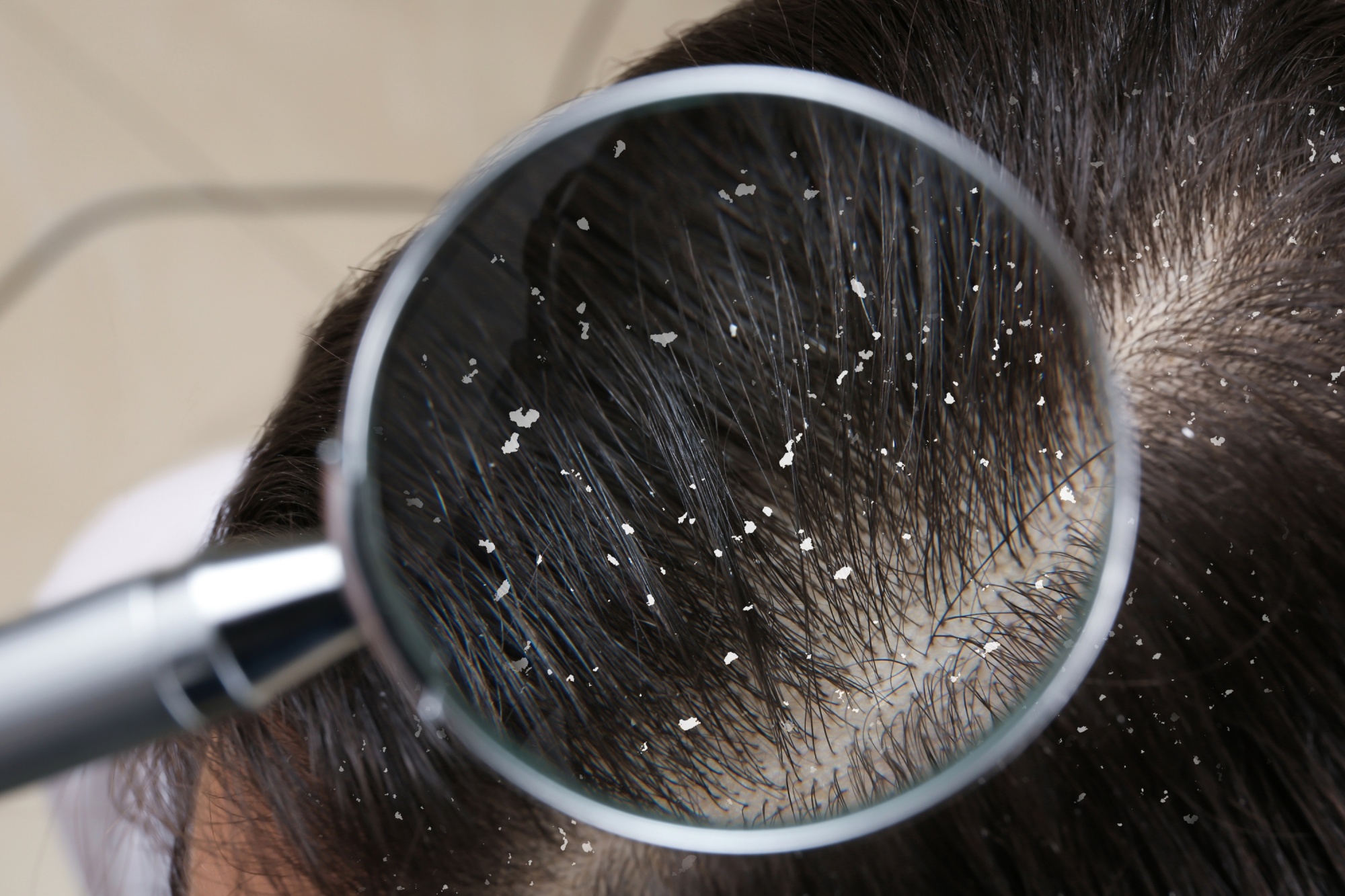 Benefits of pH Balanced Shampoo for Oily Scalp and Hair Strength