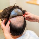 buy mens toupee online