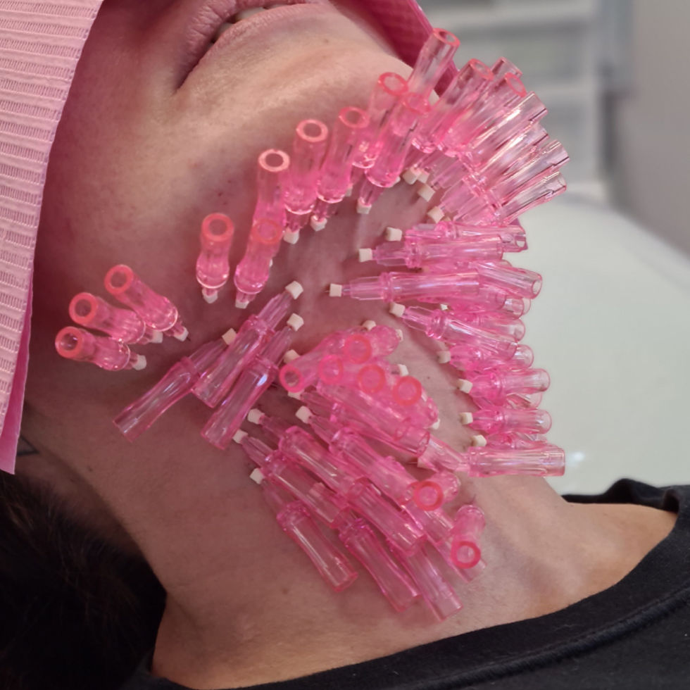 Are PDO Mono Threads Worth It for Non-Surgical Lifting?