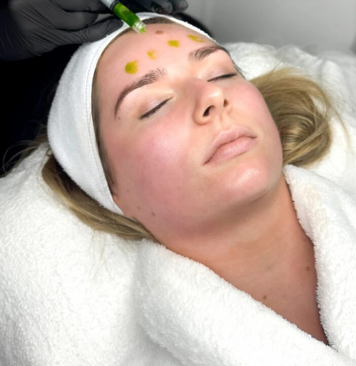 Biorepeel In Manchester – Revitalize Your Skin with Advanced Peeling