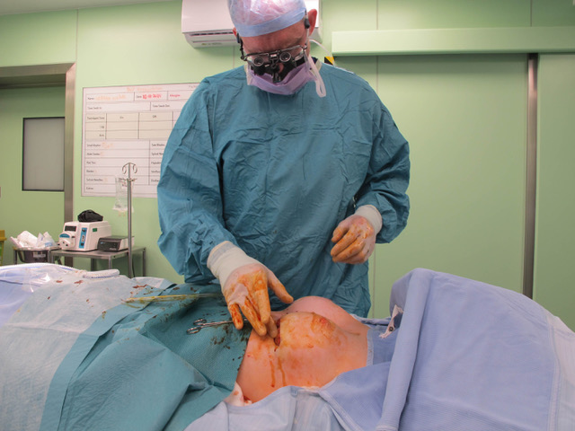 Thinking of Balanced Beauty Look at Breast Surgery Clinic