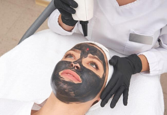 Can Laser Carbon Peel reduce enlarged pores quickly?