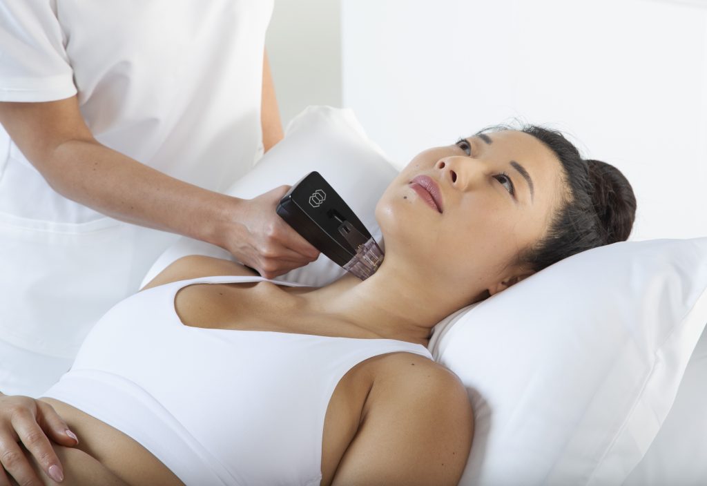 How Can Morpheus8 improves jawline definition?