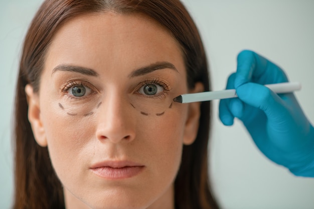 Can Under Eye Fillers Improve a Sunken Eye Appearance?