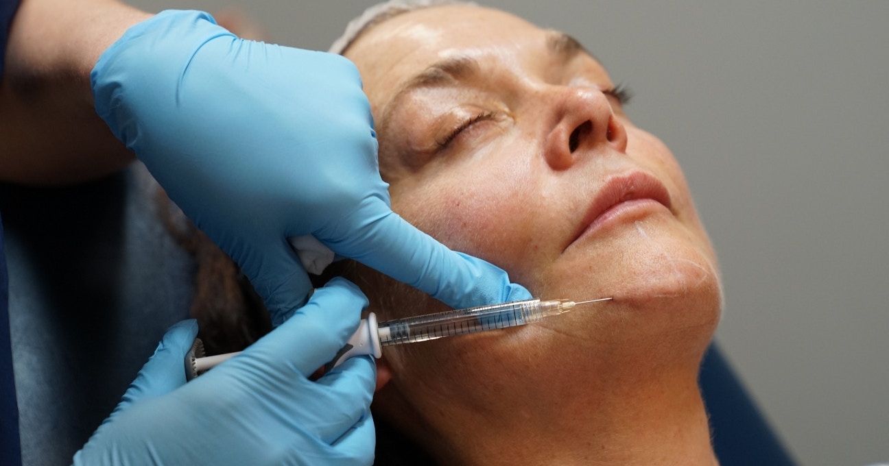 Can Volift Fillers Define Jawline and Cheeks?