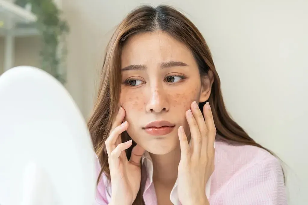 Concerned About a Skin Issue? An Online Dermatology NP Can Help