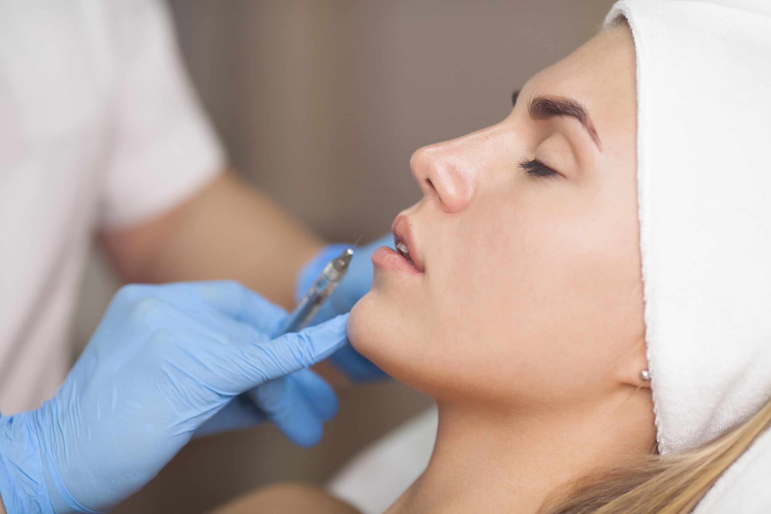 How Are Volift Fillers Used for Lip Enhancement?