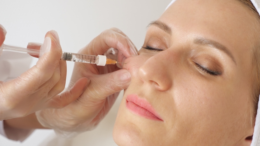 How Do Cheek Fillers Improve Youthful Cheek Appearance?