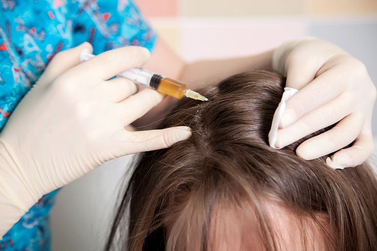 How Do I Get Thicker Hair With PRP Hair Treatment?