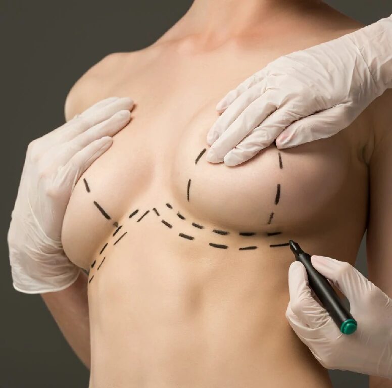 How Does Breast Lift Surgery Create Firmer Breasts?