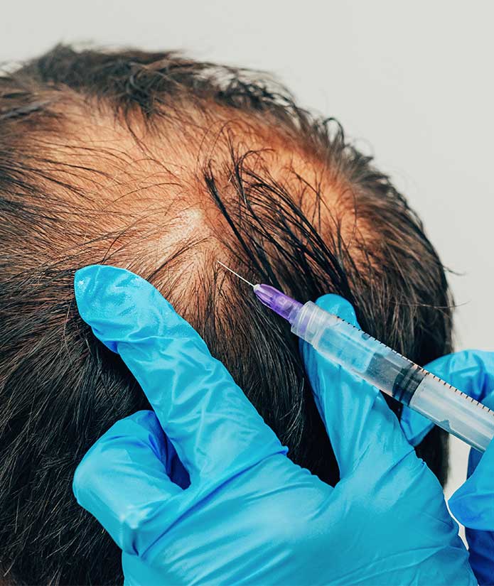 How Effective Is G Cell Hair Treatment for Hair Regrowth?