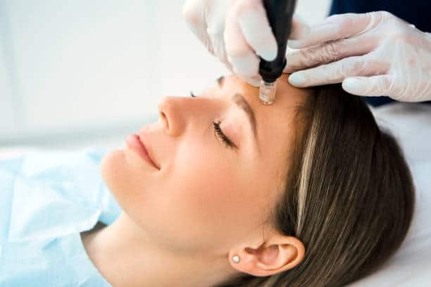 How Fast Microneedling for Acne Scars Abu Dhabi Works