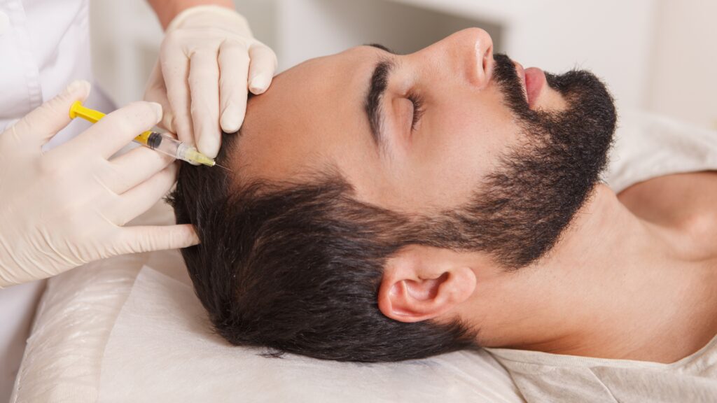 How Long Does Stem Cell Hair Transplant Last?