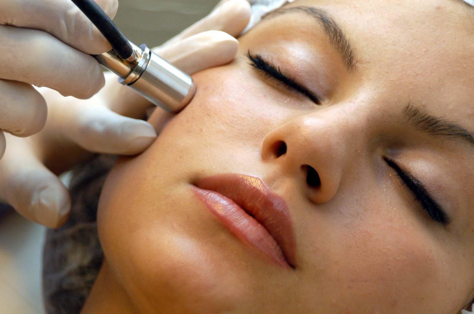How Quickly Does Microdermabrasion Treatment Work?