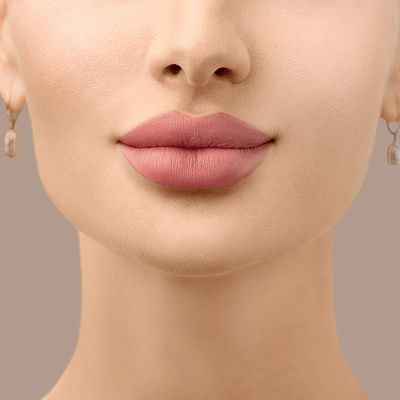 How Long Does Russian Lip Filler in Dubai Last?