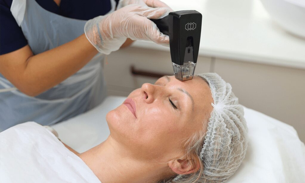 How does Morpheus8 improve your skin elasticity?
