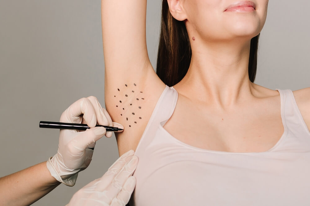 Improve Your Quality of Life with Hyperhidrosis Treatment
