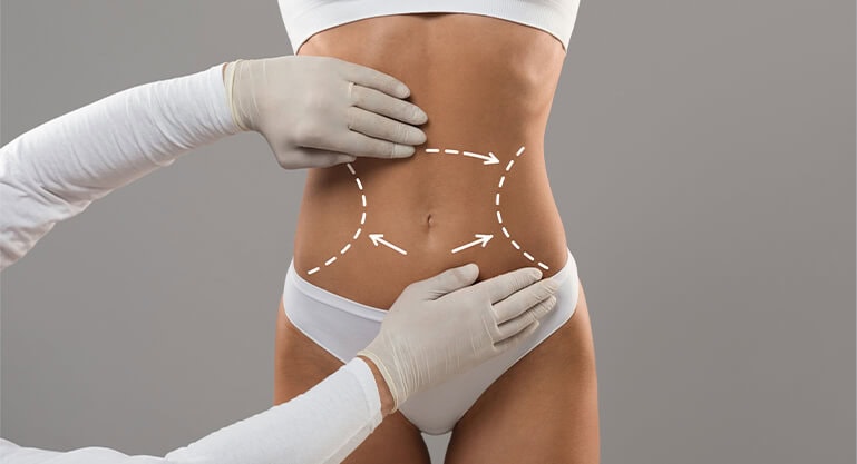 Is Mini Abdominoplasty Abu Dhabi Good After Pregnancy?