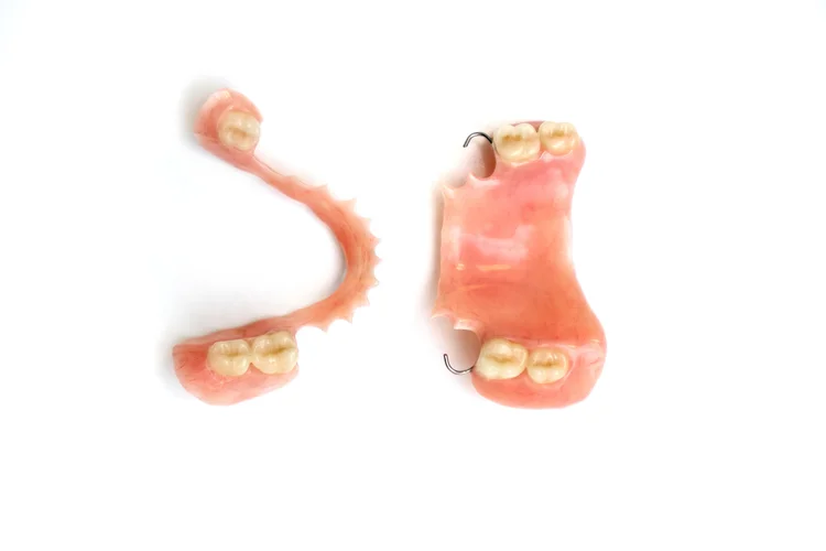 Dental Implants Hamilton – A Safe Way To Get Your Smile Back