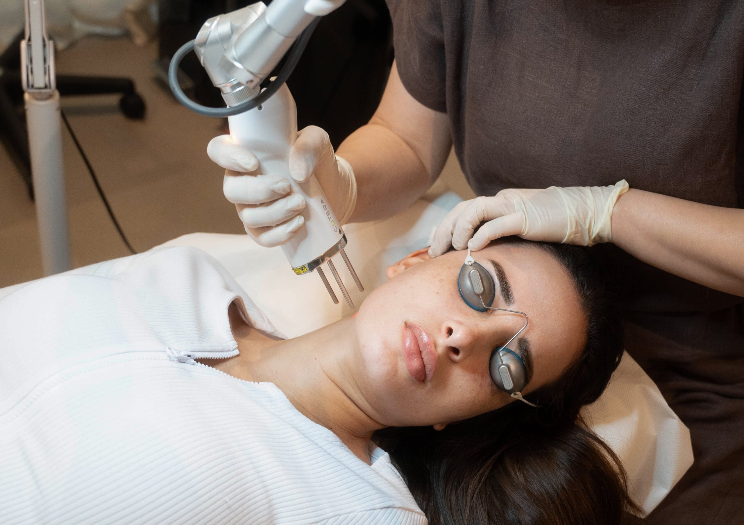 Picosure Laser Treatment transforms dull skin into radiant beauty glow