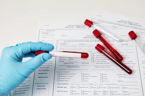 Pregnancy Blood Test Results Chart: Understanding hCG Measurements