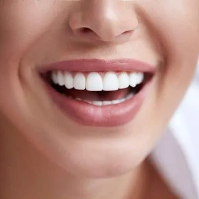 Bring Out Bold Shine With Expert Teeth Whitening Technique