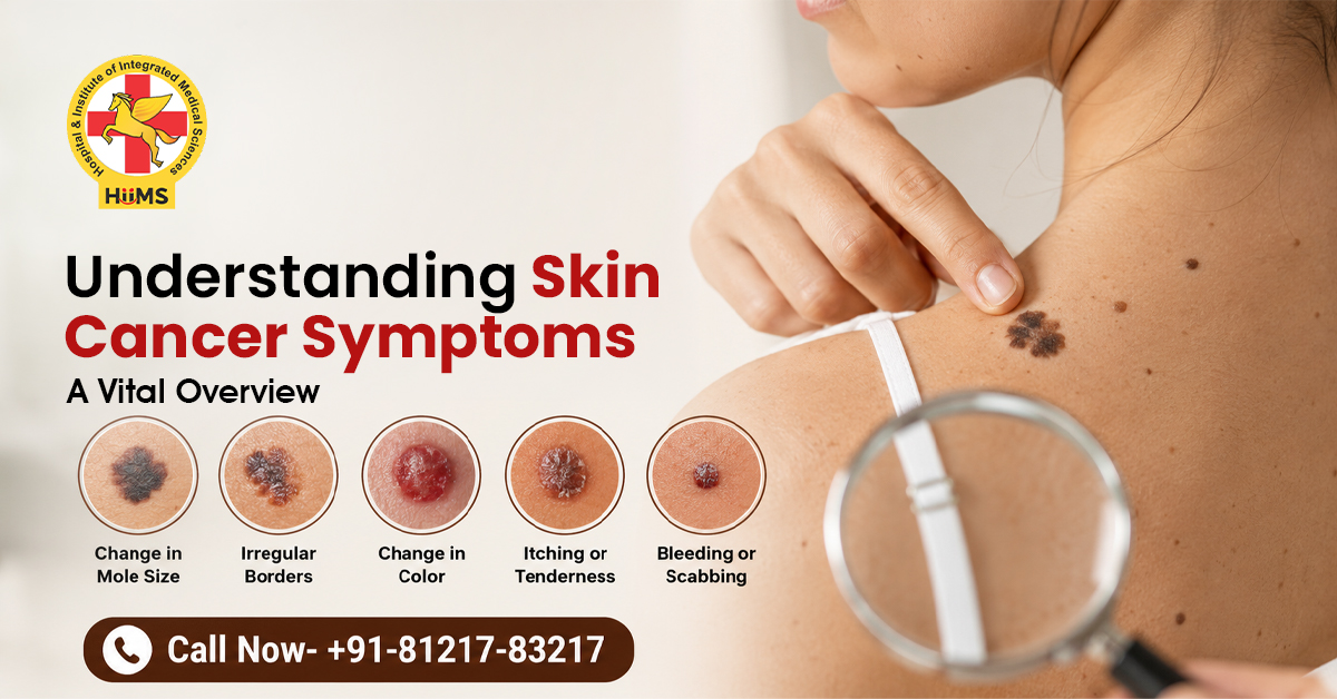 Don’t Ignore These Skin Cancer Symptoms: Early Signs That Matter